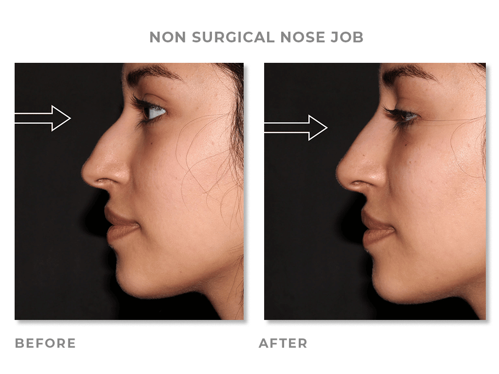 fatima nose final