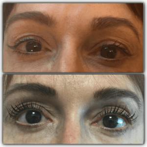 lash extensions in denver colorado