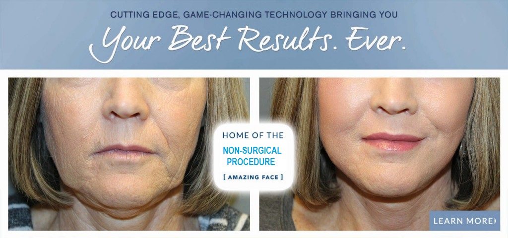 best non surgical facelift in denver and broomfield, colorado