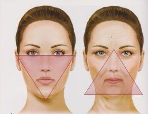 how fillers can change the shape of your face