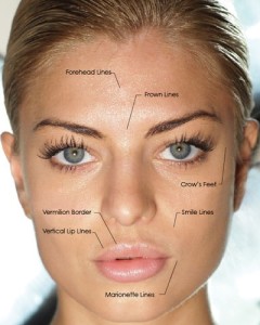 denver botox and fillers