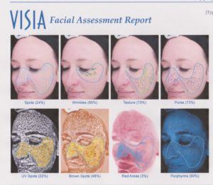 visia skin analysis image