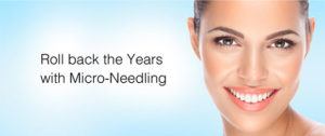 microneedling facial