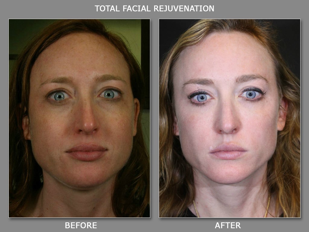 Obagi Skin Care Products Denver, Broomfield Med Spa & Skin Care